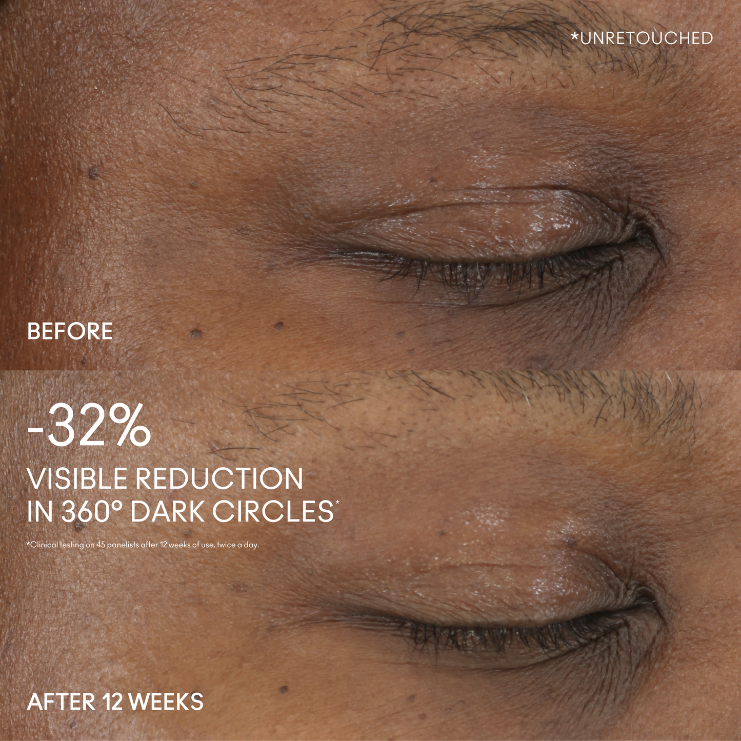 Hyper Real Serumizer Eye 360 Bright Eye Treatment with a refreshed looking eye area for Daily Makeup